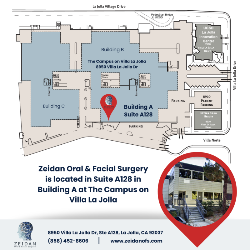 Zeidan OFS location illustration
